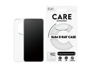 CARE by PanzerGlass X-Ray - Zadní kryt pro mobilní telefon - termoplastický polyuretan (TP
